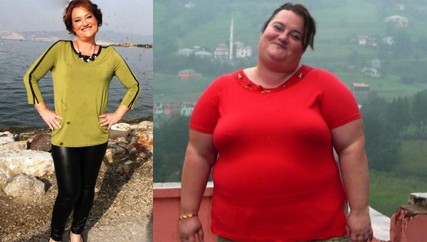 Kirurg plastik Dëshmi – Si ndryshoi jeta ime pasi vura unazën gastrite dhe shpëtova nga obeziteti