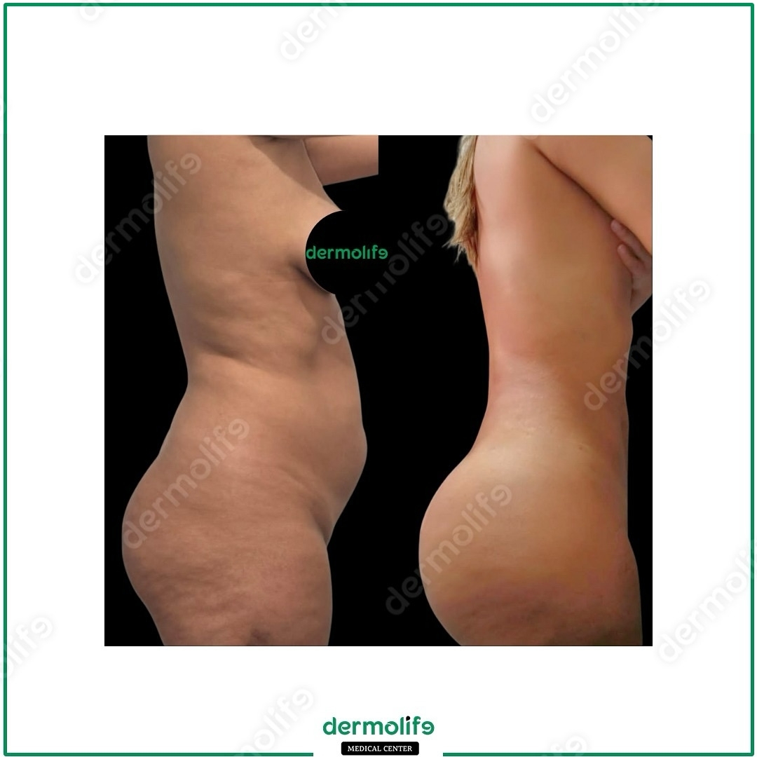 liposkulptura pamja 33