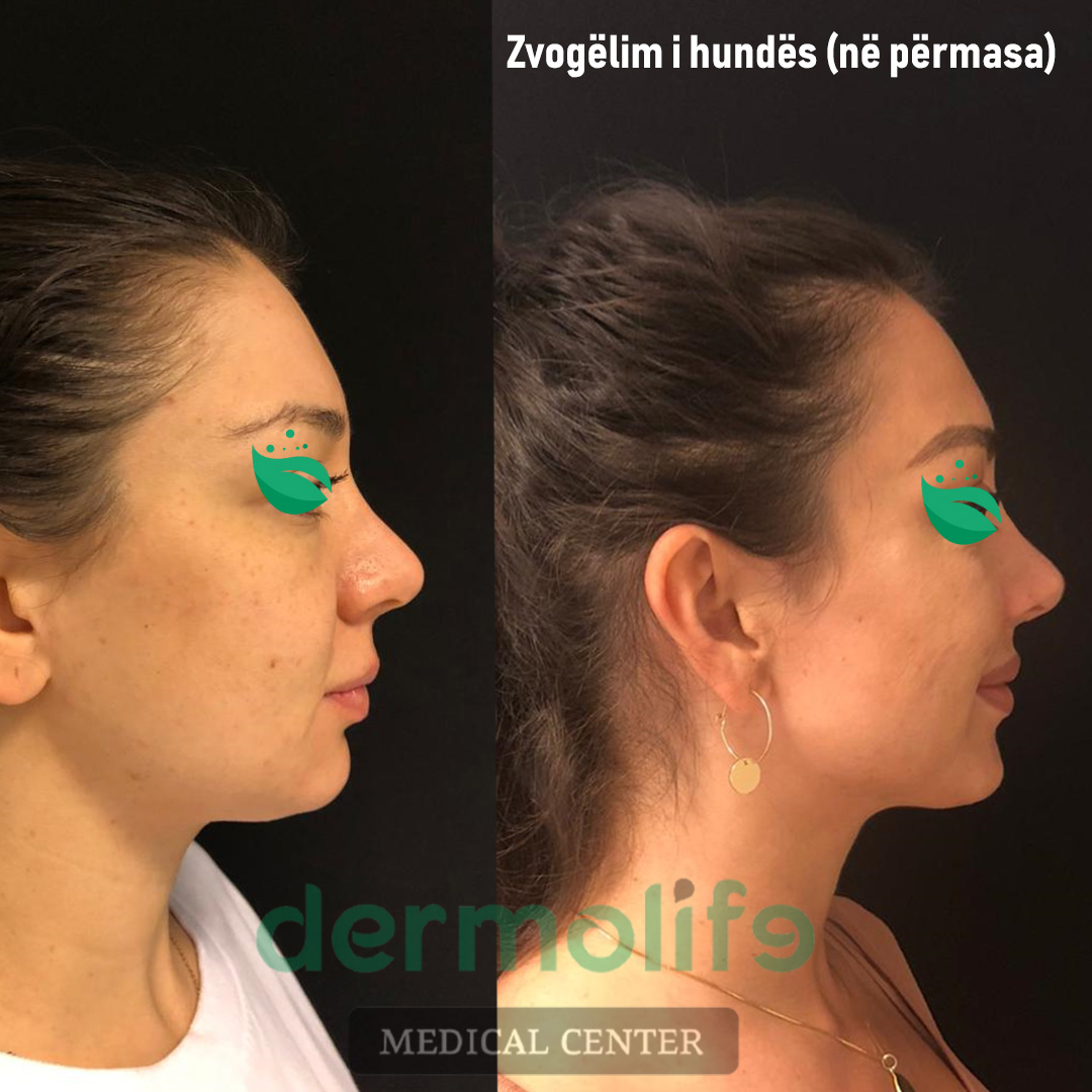 rimodelimi i hundes pamja 15 dermolife