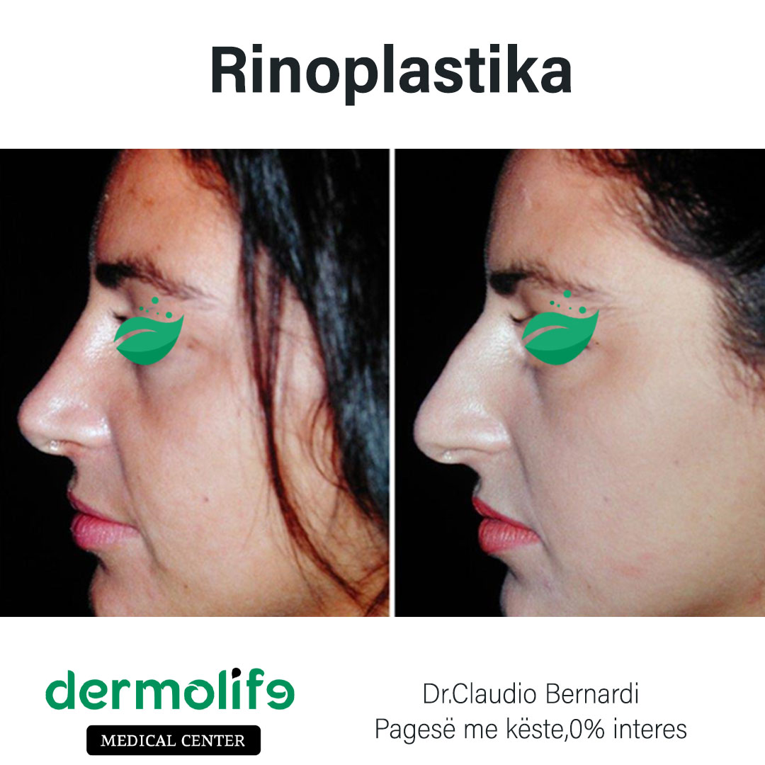 rimodelimi i hundes pamja 10 dermolife