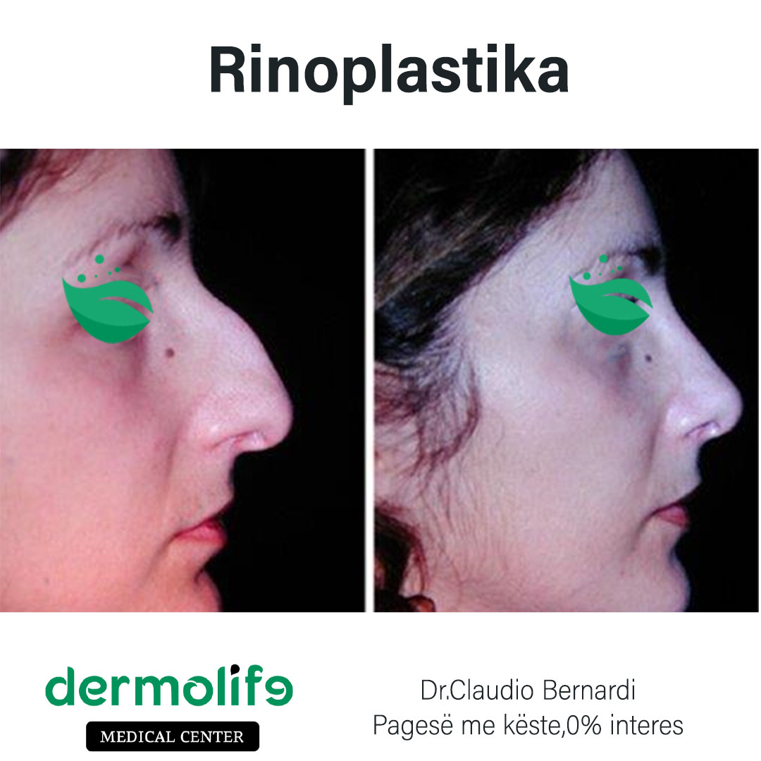 rimodelimi i hundes pamja 12 dermolife